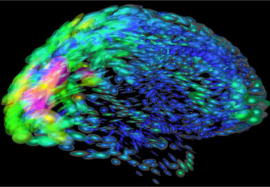 Los organoides cerebrales ganan realismo gracias a una nueva plataforma experimental en ratón Los organoides cerebrales ganan realismo gracias a una nueva plataforma experimental en ratón